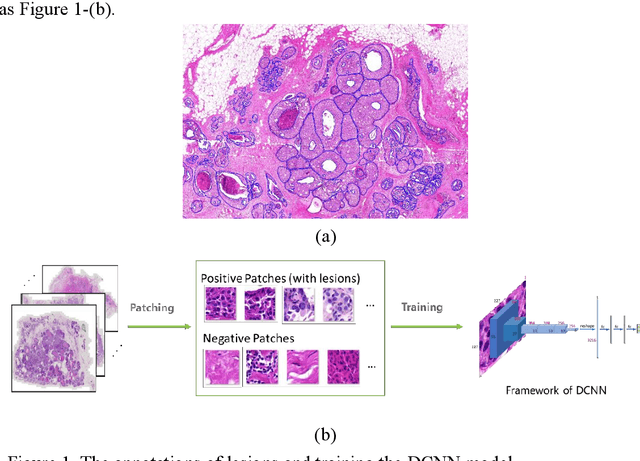 Figure 1 for Understanding the Mechanism of Deep Learning Framework for Lesion Detection in Pathological Images with Breast Cancer
