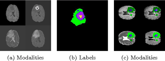 Figure 3 for 3-D Convolutional Neural Networks for Glioblastoma Segmentation
