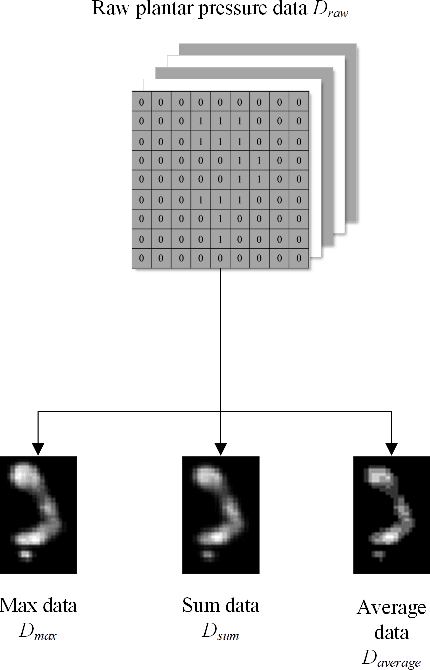 Figure 1 for A Model for Medical Diagnosis Based on Plantar Pressure