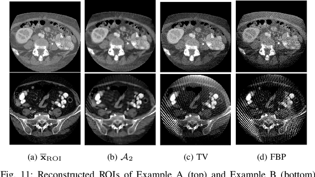 Figure 3 for Deep Unfolding of the DBFB Algorithm with Application to ROI CT Imaging with Limited Angular Density