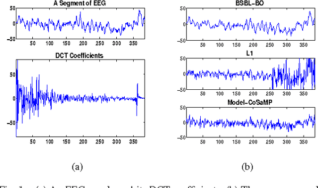 Figure 1 for Compressed Sensing of EEG for Wireless Telemonitoring with Low Energy Consumption and Inexpensive Hardware