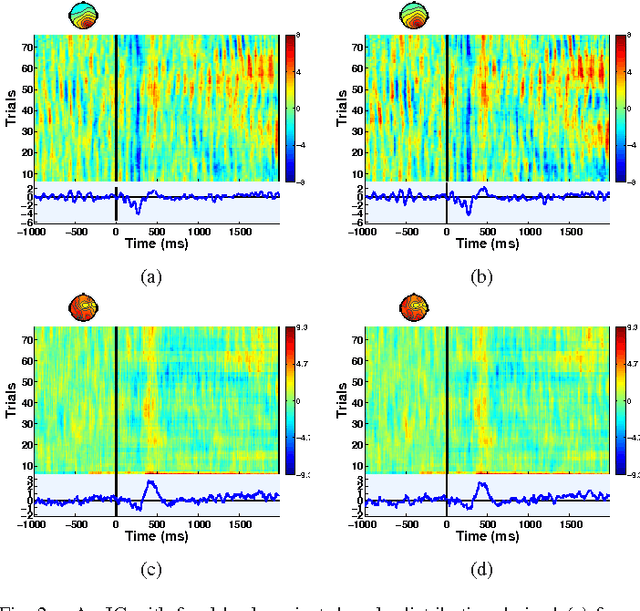 Figure 2 for Compressed Sensing of EEG for Wireless Telemonitoring with Low Energy Consumption and Inexpensive Hardware