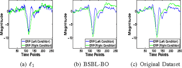 Figure 3 for Compressed Sensing of EEG for Wireless Telemonitoring with Low Energy Consumption and Inexpensive Hardware