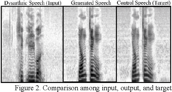 Figure 3 for Improving Dysarthric Speech Intelligibility Using Cycle-consistent Adversarial Training