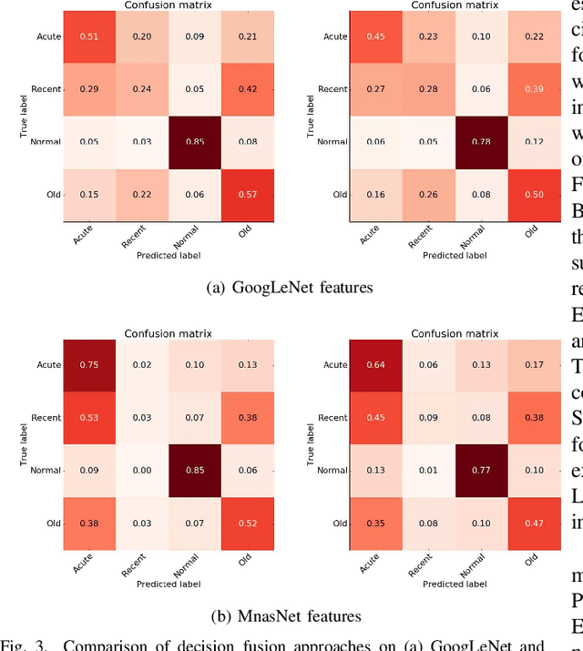 Figure 3 for DeepMI: Deep Multi-lead ECG Fusion for Identifying Myocardial Infarction and its Occurrence-time