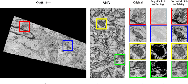 Figure 3 for Deep learning based domain adaptation for mitochondria segmentation on EM volumes
