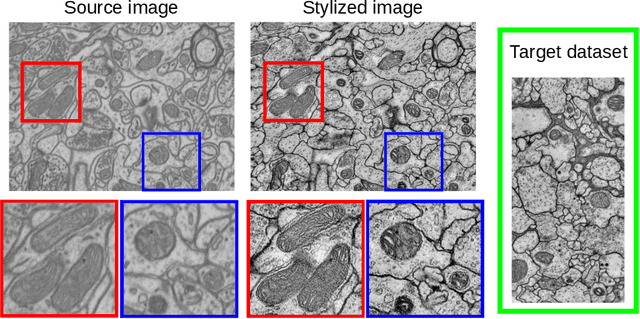 Figure 4 for Deep learning based domain adaptation for mitochondria segmentation on EM volumes