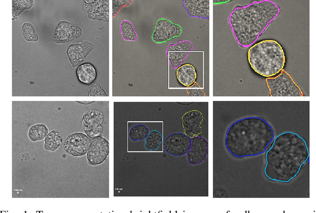 Figure 1 for Learning to segment clustered amoeboid cells from brightfield microscopy via multi-task learning with adaptive weight selection