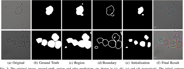 Figure 3 for Learning to segment clustered amoeboid cells from brightfield microscopy via multi-task learning with adaptive weight selection