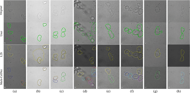 Figure 4 for Learning to segment clustered amoeboid cells from brightfield microscopy via multi-task learning with adaptive weight selection