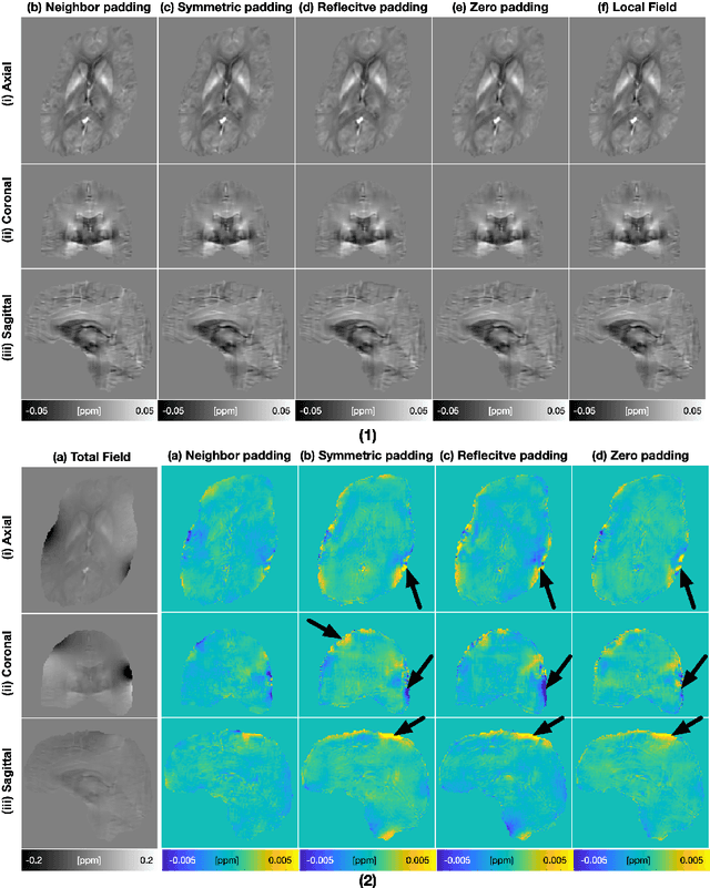 Figure 3 for Improved Padding in CNNs for Quantitative Susceptibility Mapping