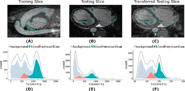 Figure 1 for Neural Style Transfer Improves 3D Cardiovascular MR Image Segmentation on Inconsistent Data