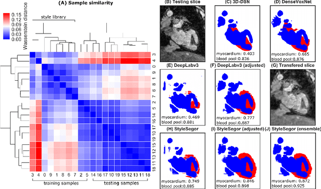 Figure 4 for Neural Style Transfer Improves 3D Cardiovascular MR Image Segmentation on Inconsistent Data