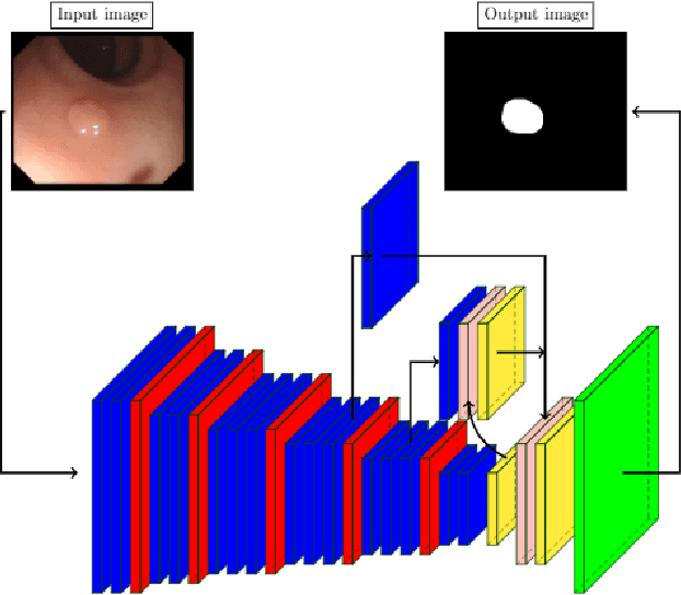 Figure 1 for Uncertainty and Interpretability in Convolutional Neural Networks for Semantic Segmentation of Colorectal Polyps