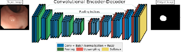 Figure 3 for Uncertainty and Interpretability in Convolutional Neural Networks for Semantic Segmentation of Colorectal Polyps