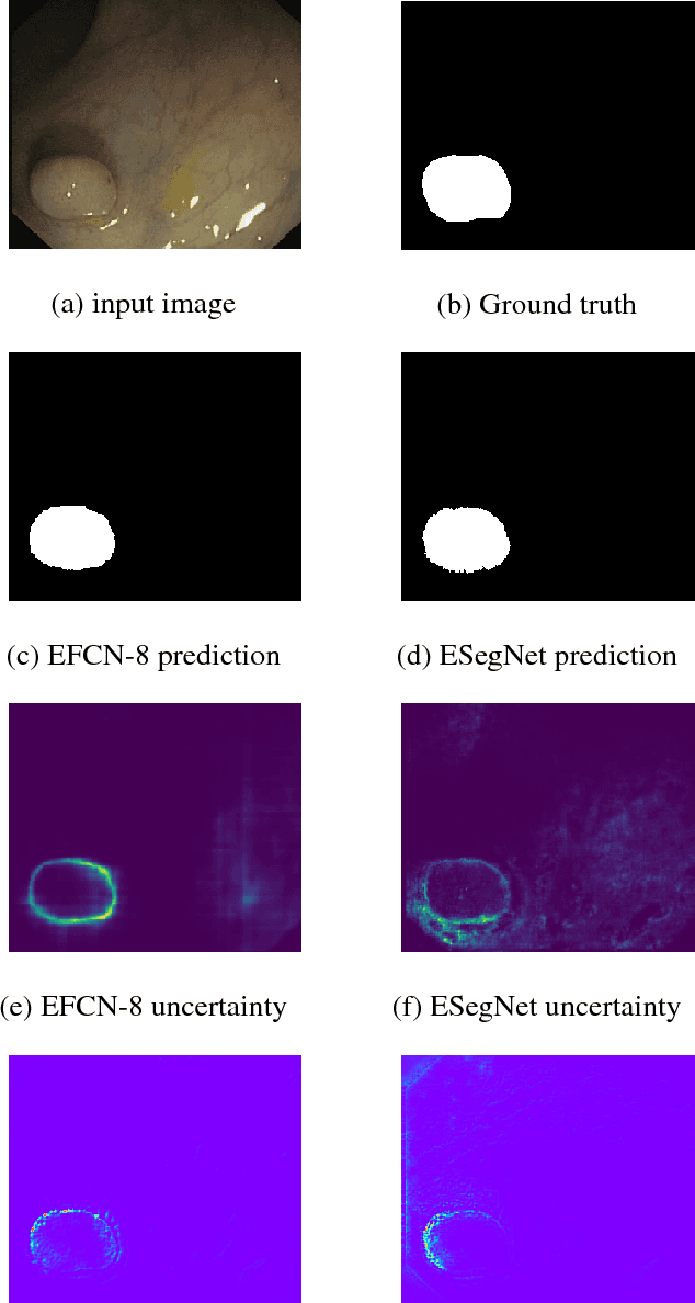 Figure 4 for Uncertainty and Interpretability in Convolutional Neural Networks for Semantic Segmentation of Colorectal Polyps