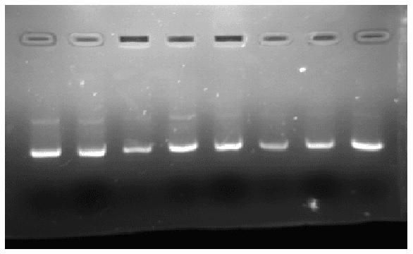 Figure 1 for An Analysis System for DNA Gel Electrophoresis Images Based on Automatic Thresholding an Enhancement