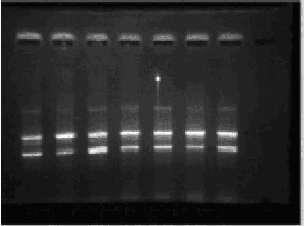 Figure 3 for An Analysis System for DNA Gel Electrophoresis Images Based on Automatic Thresholding an Enhancement