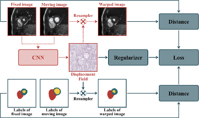 Figure 1 for Enhancing Label-Driven Deep Deformable Image Registration with Local Distance Metrics for State-of-the-Art Cardiac Motion Tracking