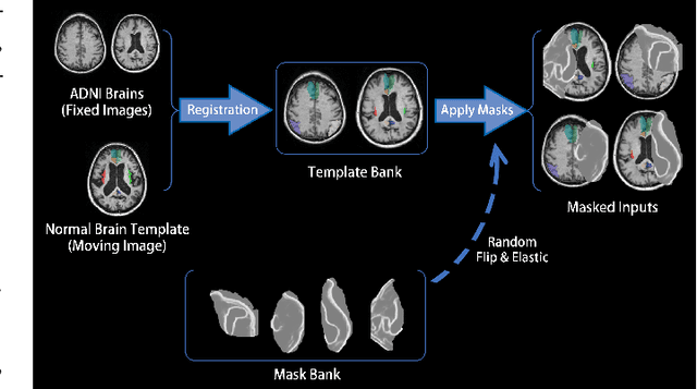 Figure 4 for TBI-GAN: An Adversarial Learning Approach for Data Synthesis on Traumatic Brain Segmentation