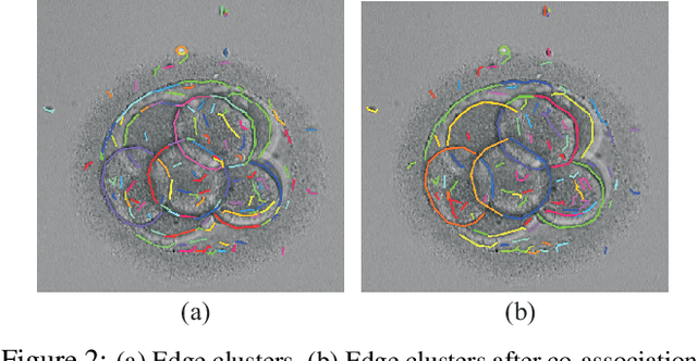 Figure 2 for Preimplantation Blastomere Boundary Identification in HMC Microscopic Images of Early Stage Human Embryos
