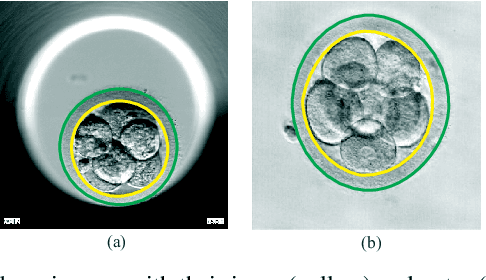 Figure 4 for Preimplantation Blastomere Boundary Identification in HMC Microscopic Images of Early Stage Human Embryos