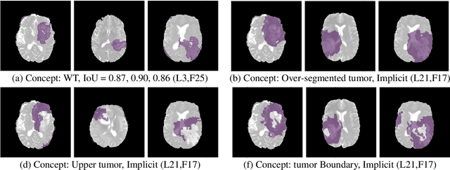 Figure 4 for Demystifying Brain Tumour Segmentation Networks: Interpretability and Uncertainty Analysis