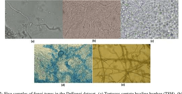 Figure 3 for DeFungi: Direct Mycological Examination of Microscopic Fungi Images