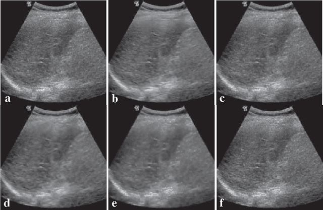 Figure 1 for Robust non-local means filter for ultrasound image denoising