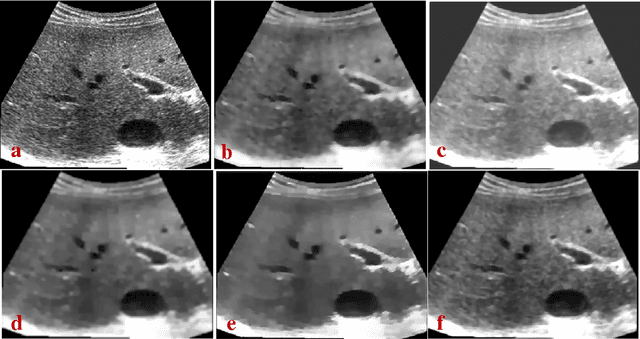 Figure 2 for Robust non-local means filter for ultrasound image denoising
