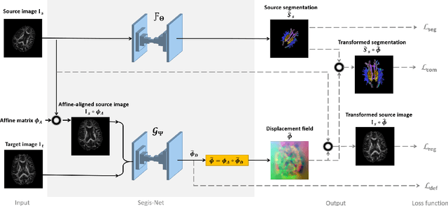 Figure 1 for Longitudinal diffusion MRI analysis using Segis-Net: a single-step deep-learning framework for simultaneous segmentation and registration