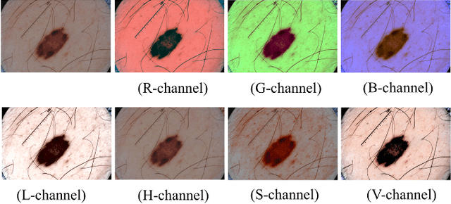 Figure 2 for Automatic skin lesion segmentation with fully convolutional-deconvolutional networks