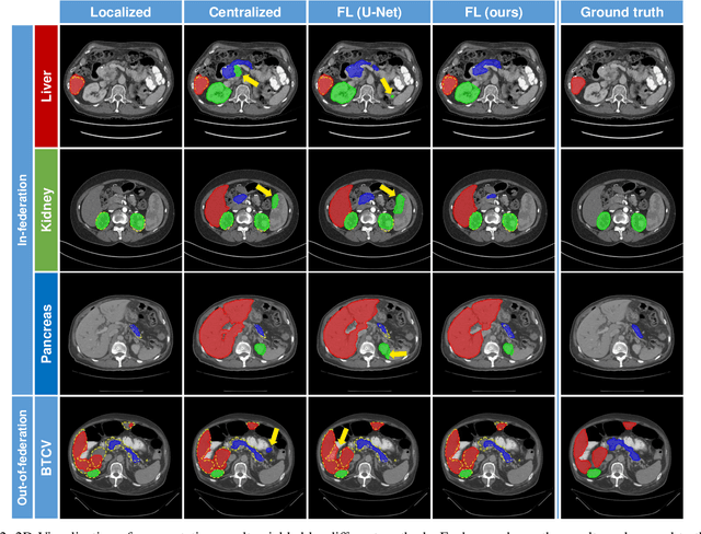 Figure 2 for Federated Multi-organ Segmentation with Partially Labeled Data