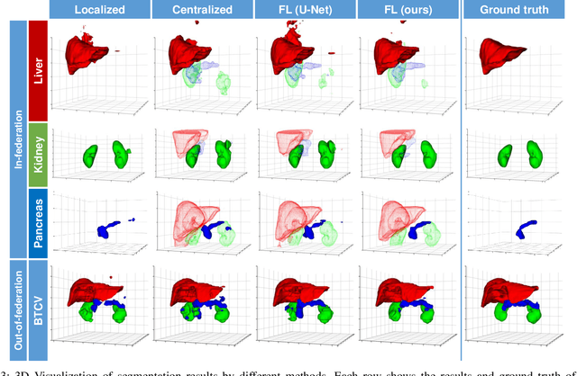 Figure 3 for Federated Multi-organ Segmentation with Partially Labeled Data