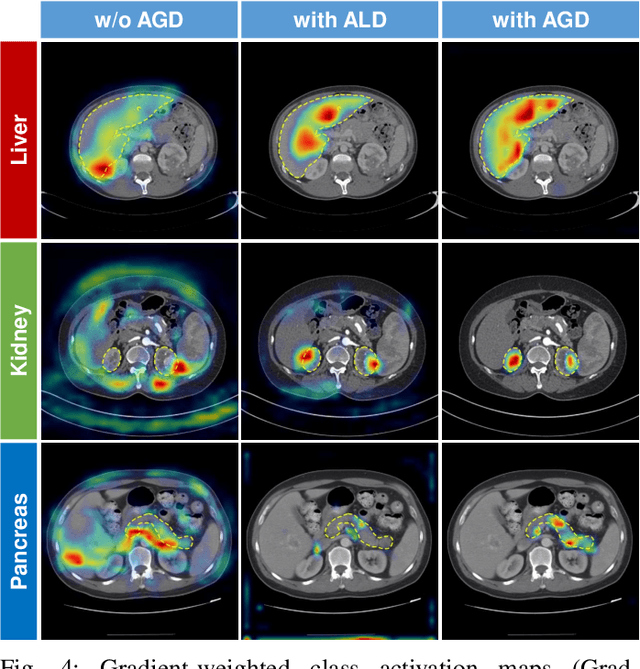 Figure 4 for Federated Multi-organ Segmentation with Partially Labeled Data