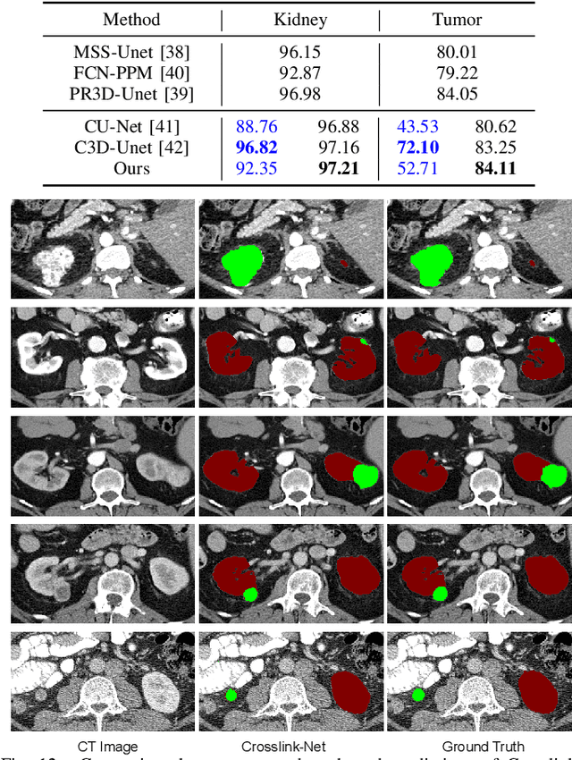Figure 4 for Crosslink-Net: Double-branch Encoder Segmentation Network via Fusing Vertical and Horizontal Convolutions