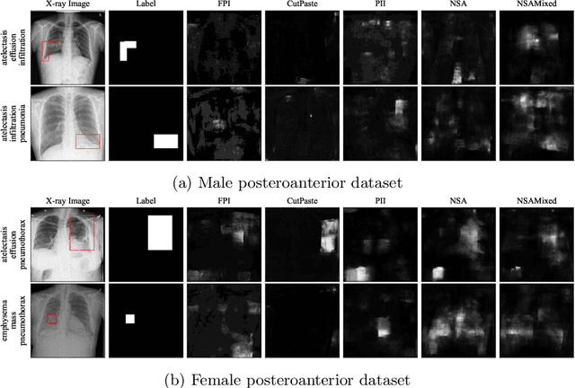 Figure 3 for nnOOD: A Framework for Benchmarking Self-supervised Anomaly Localisation Methods