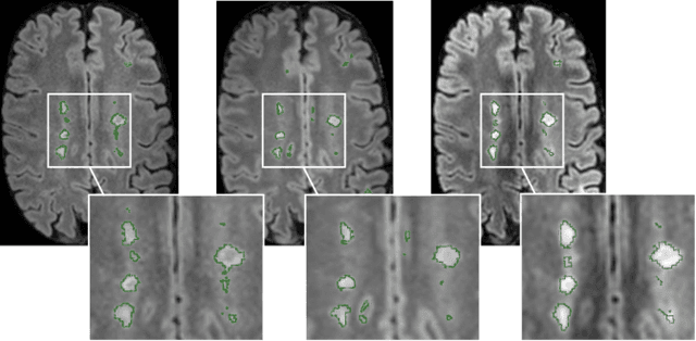 Figure 1 for Improved inter-scanner MS lesion segmentation by adversarial training on longitudinal data