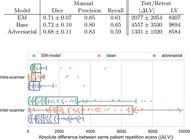 Figure 2 for Improved inter-scanner MS lesion segmentation by adversarial training on longitudinal data