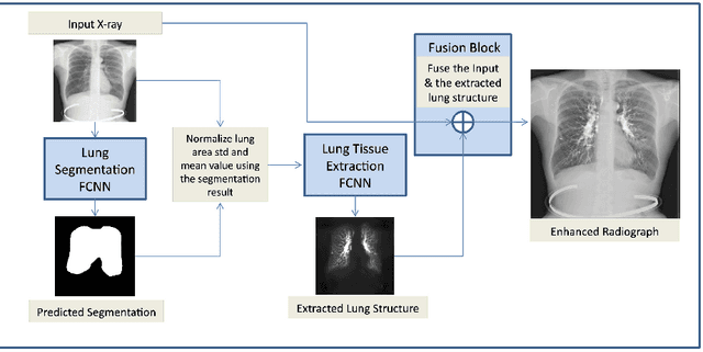Figure 1 for Lung Structures Enhancement in Chest Radiographs via CT based FCNN Training