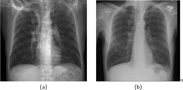 Figure 2 for Lung Structures Enhancement in Chest Radiographs via CT based FCNN Training