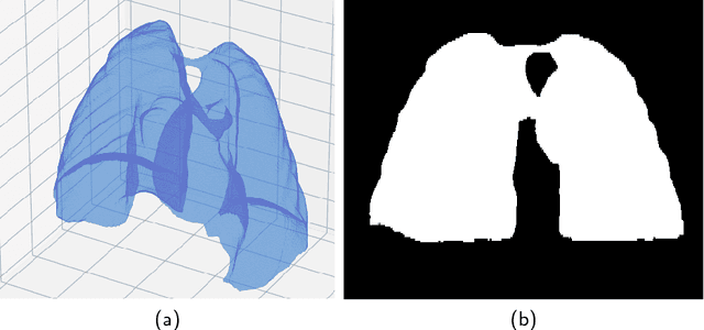 Figure 3 for Lung Structures Enhancement in Chest Radiographs via CT based FCNN Training