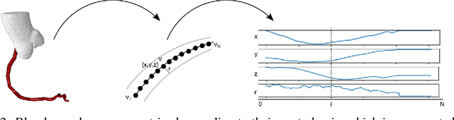 Figure 2 for Blood Vessel Geometry Synthesis using Generative Adversarial Networks