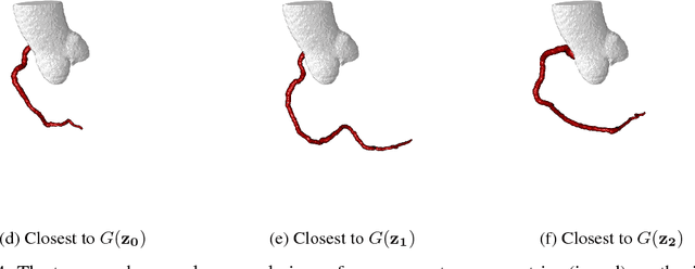 Figure 4 for Blood Vessel Geometry Synthesis using Generative Adversarial Networks