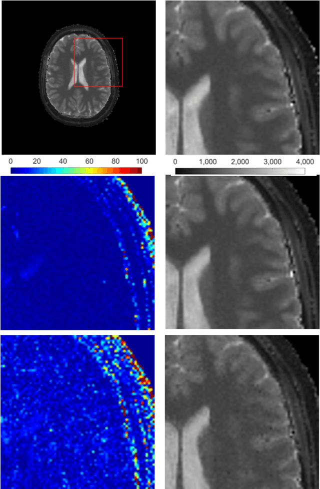 Figure 2 for Magnetic Resonance Fingerprinting Reconstruction Using Recurrent Neural Networks