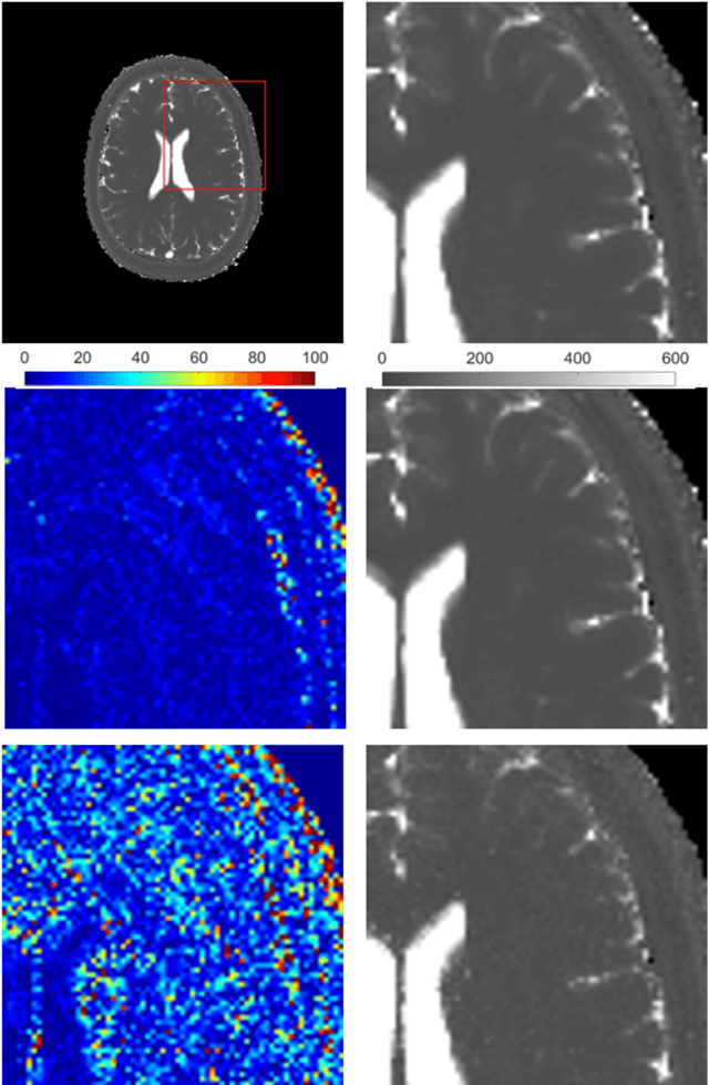 Figure 4 for Magnetic Resonance Fingerprinting Reconstruction Using Recurrent Neural Networks