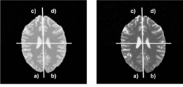 Figure 1 for Markov Random Field Segmentation of Brain MR Images