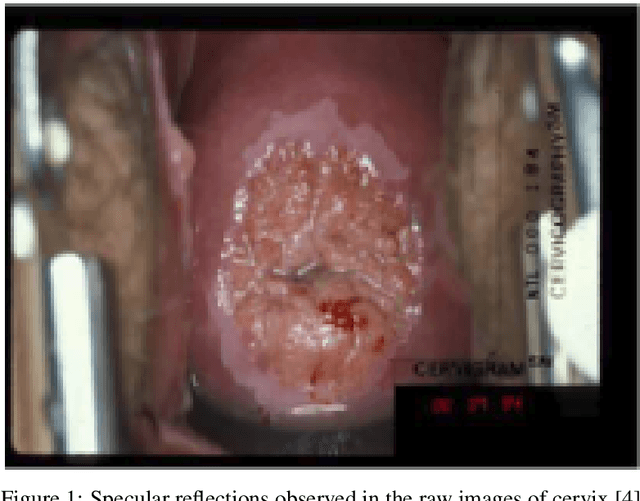 Figure 1 for Identification of Cervical Pathology using Adversarial Neural Networks