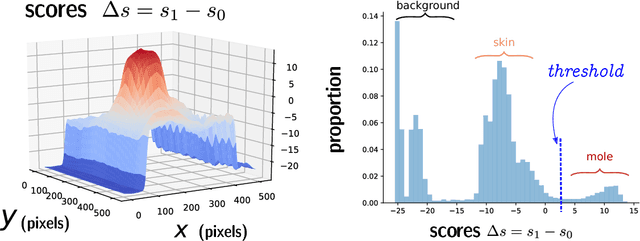 Figure 3 for Lesion segmentation using U-Net network