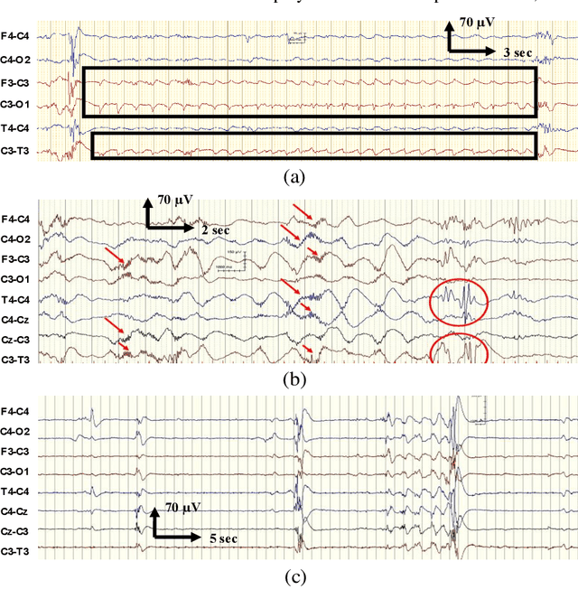 Figure 1 for Deep Learning for EEG Seizure Detection in Preterm Infants
